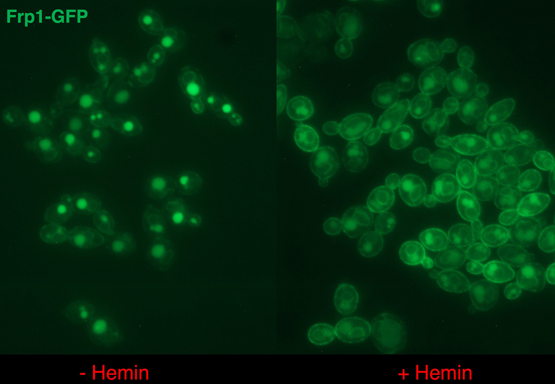 Frp1-GFP is depicted in candida cells without and with heme